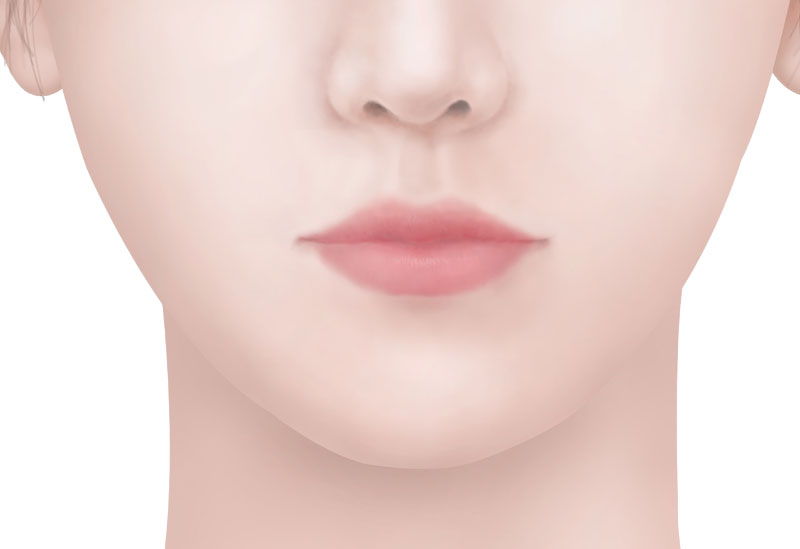 수술방법 