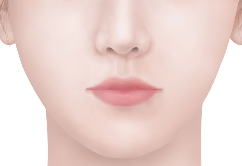 수술방법 