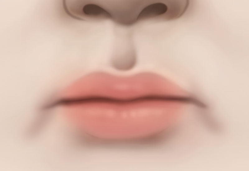 수술방법
