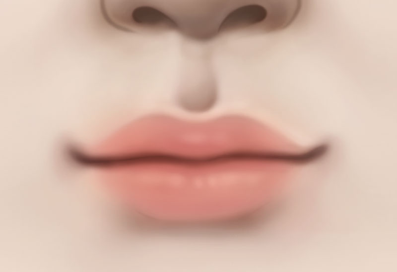 수술방법