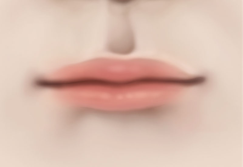 수술방법