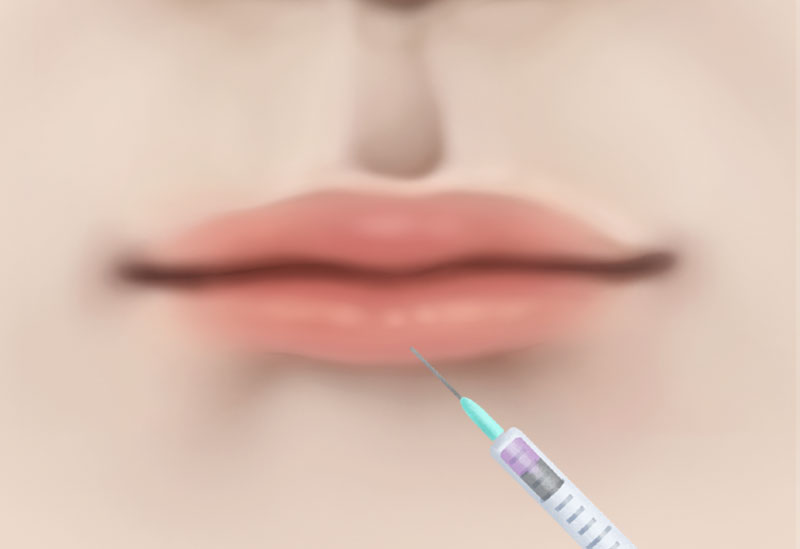 수술방법