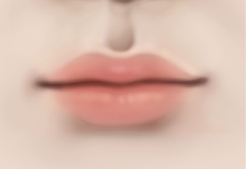 수술방법 