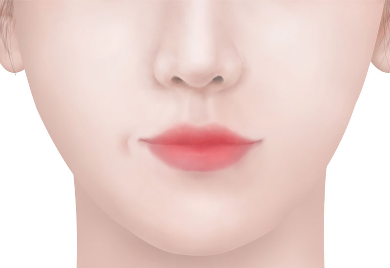 수술방법