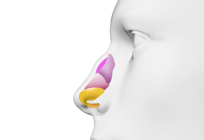 수술방법