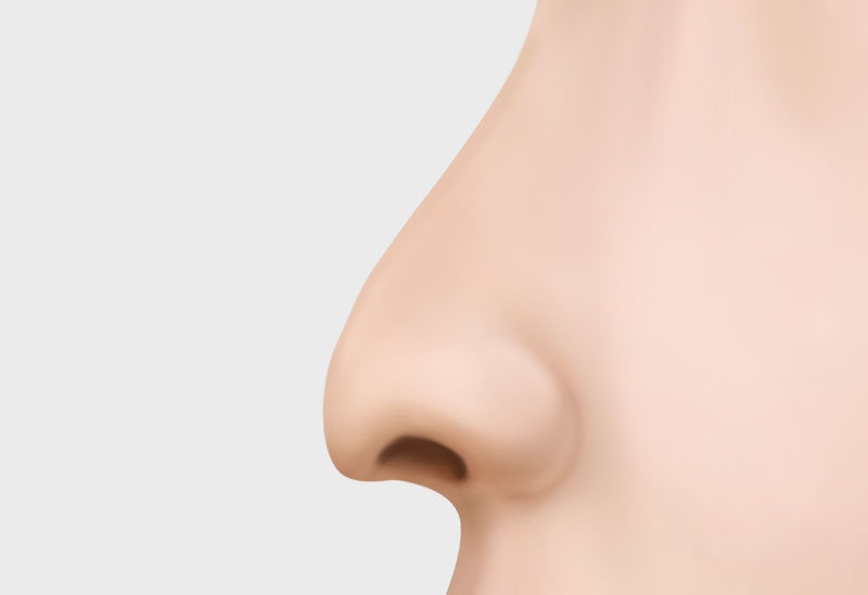 수술방법