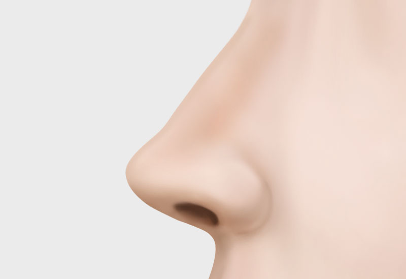 수술방법