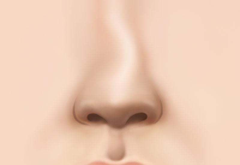 수술방법 