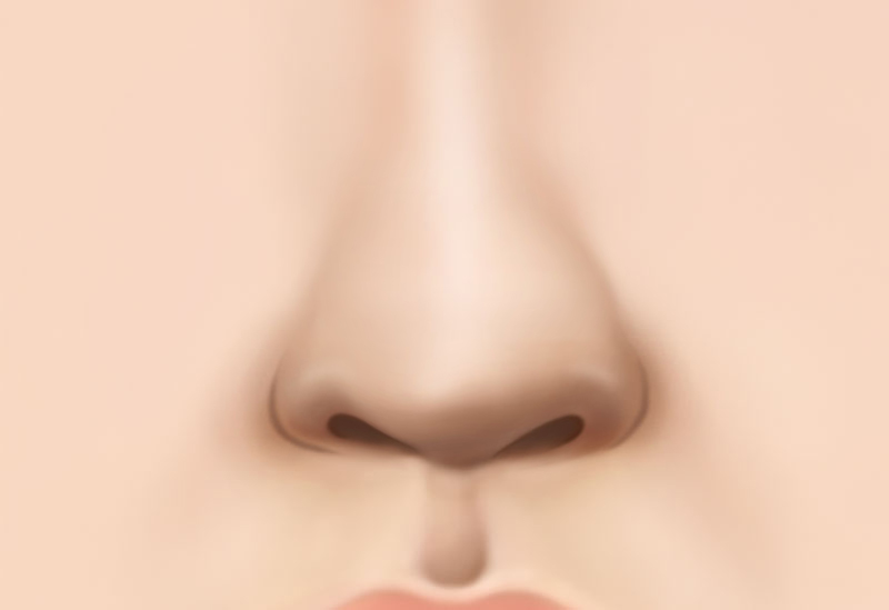 수술방법