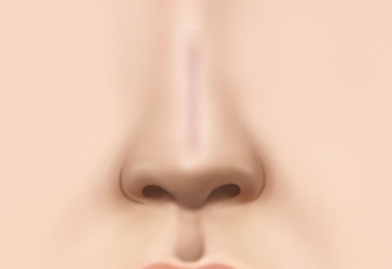 수술방법
