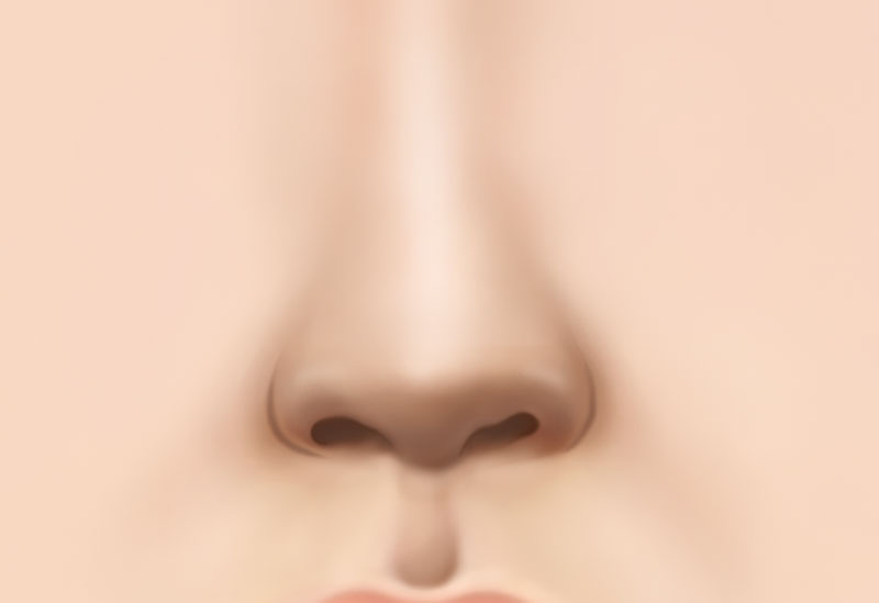 수술방법