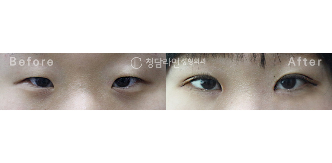 Before Image