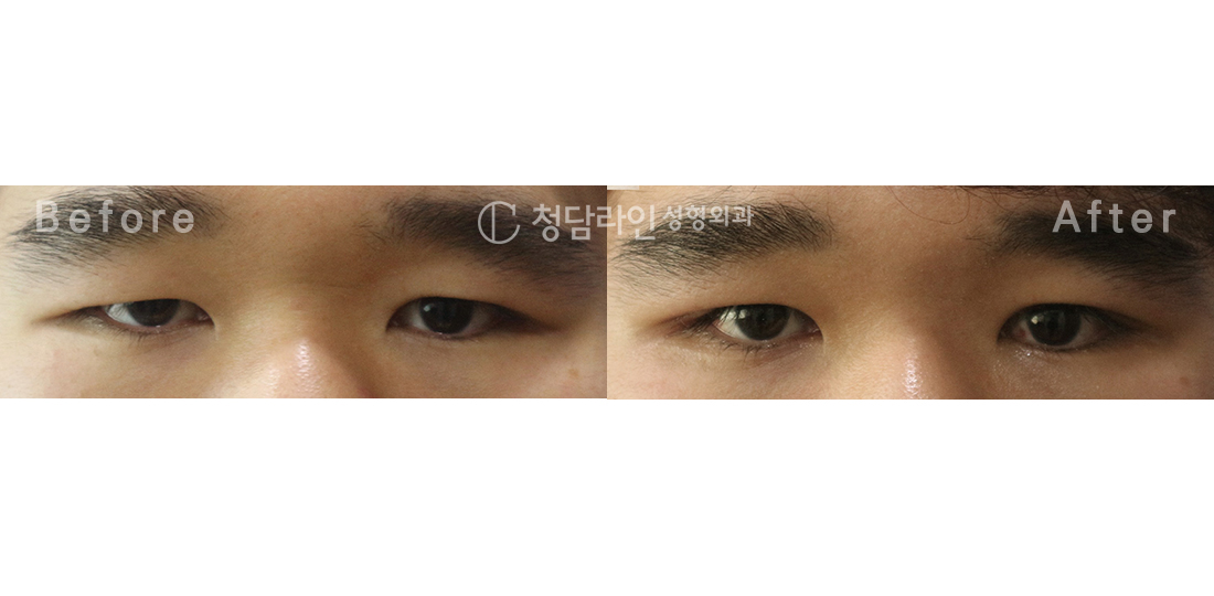 Before Image