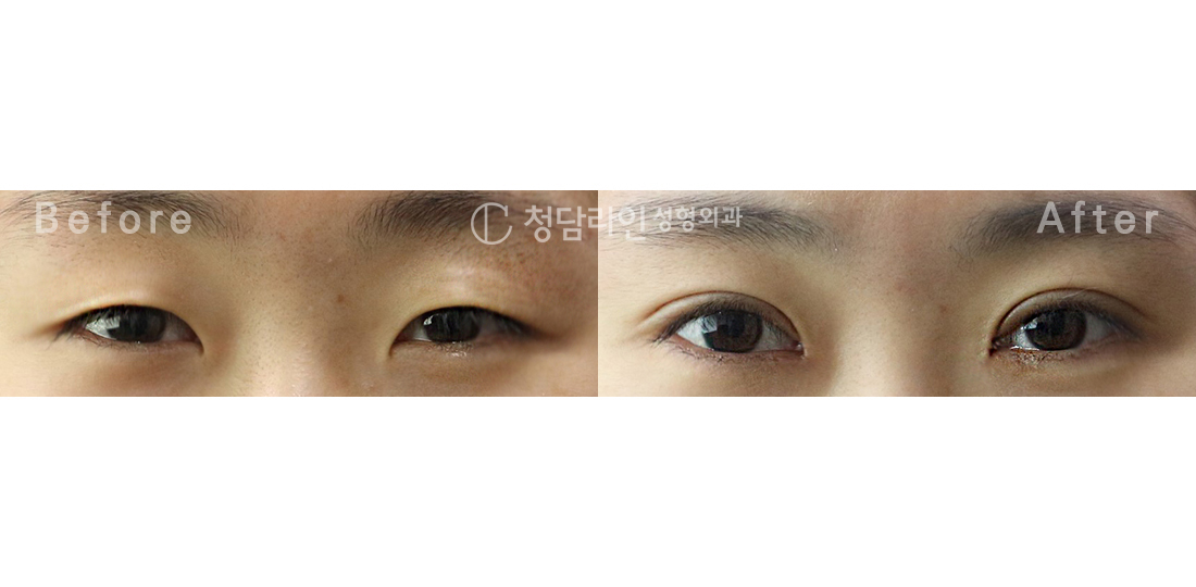 Before Image