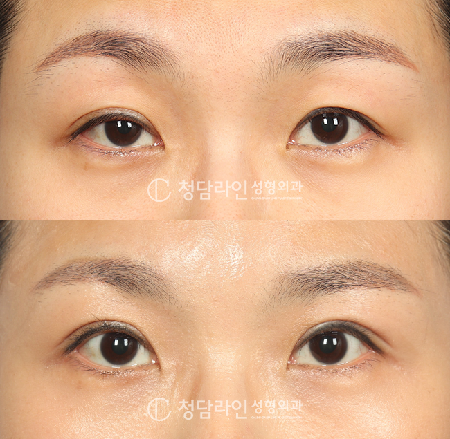 Before Image