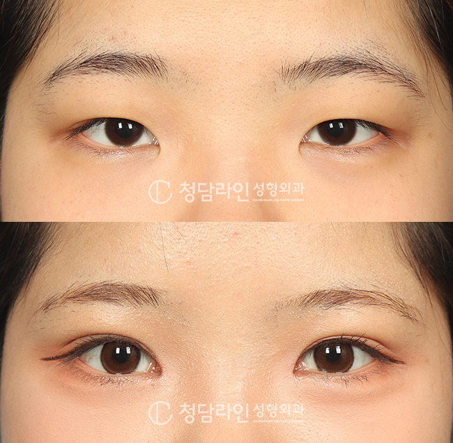 Before Image