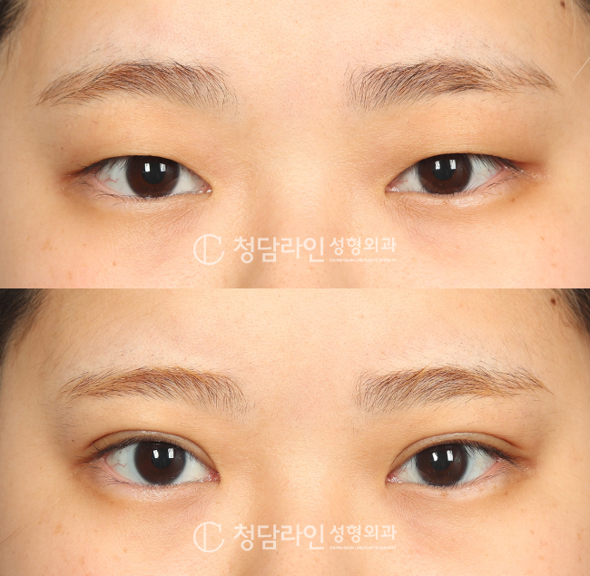 Before Image
