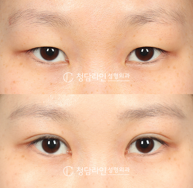 Before Image