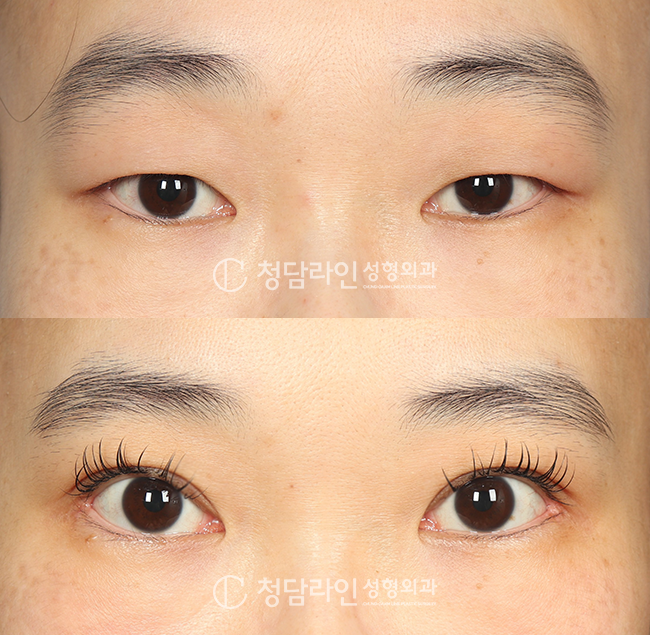 Before Image