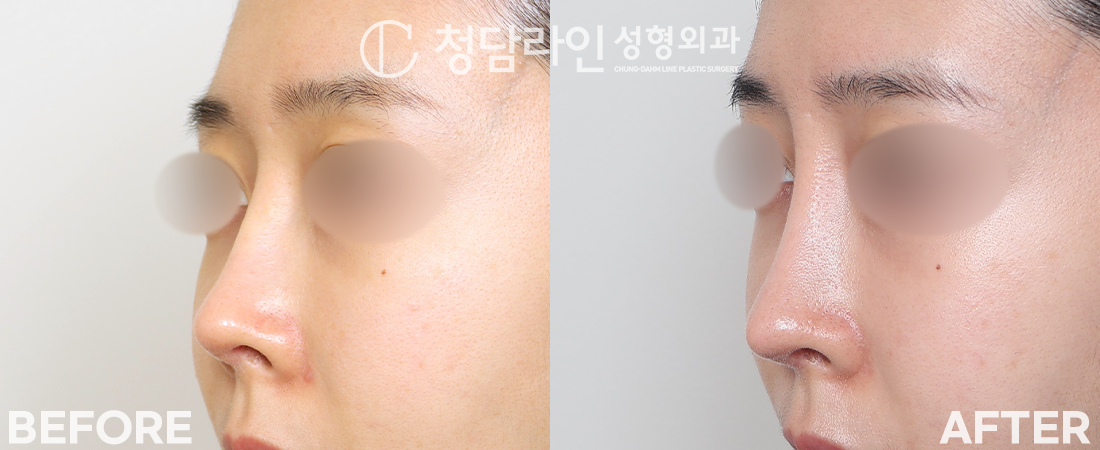 Before Image 3
