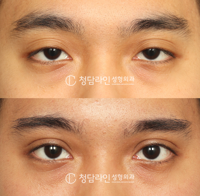 Before Image