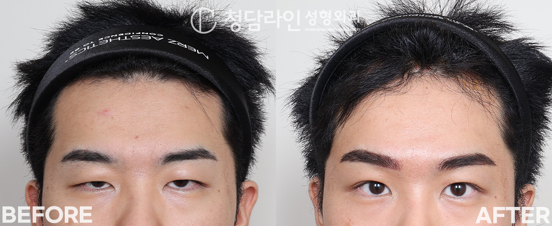 Before Image