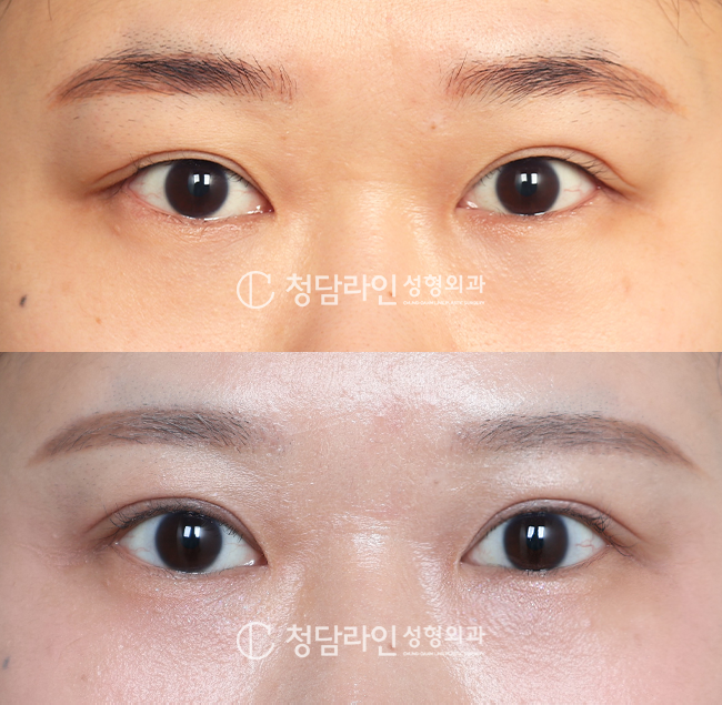 Before Image