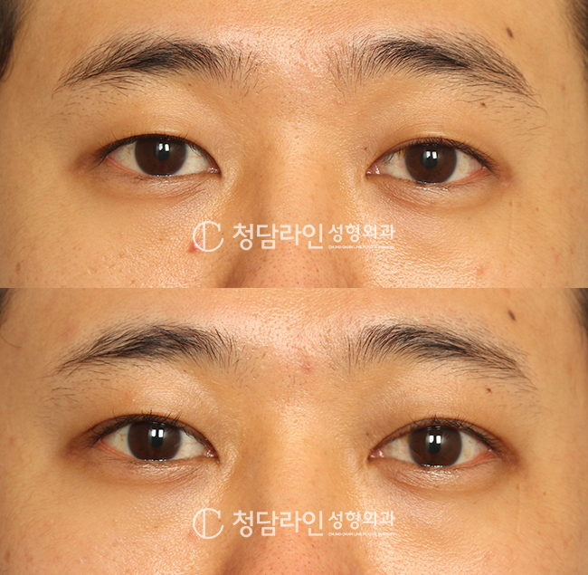 Before Image