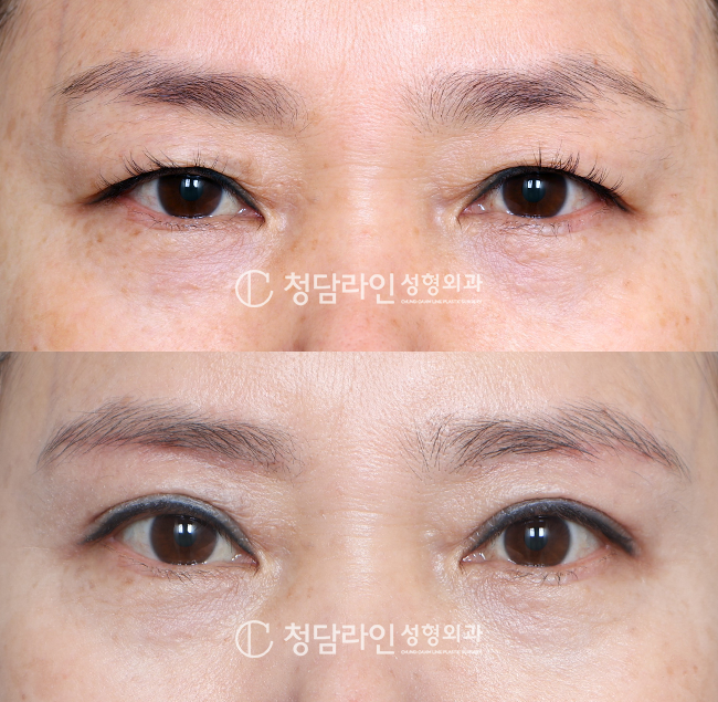 Before Image