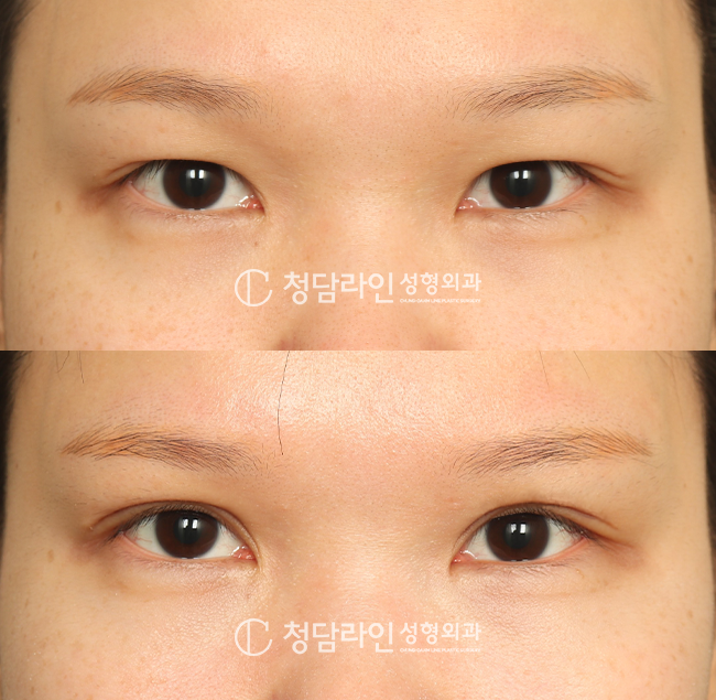 Before Image