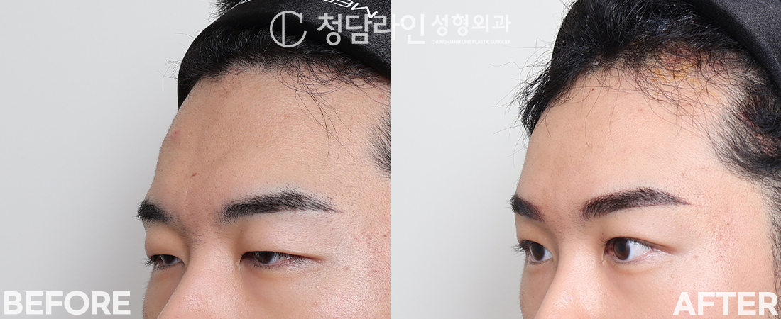 Before Image 3