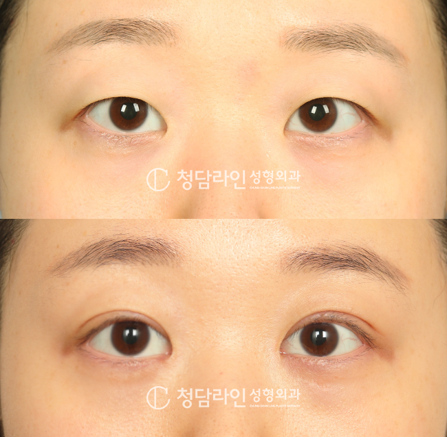 Before Image