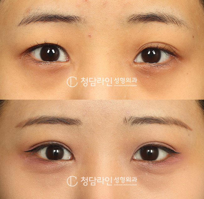 Before Image