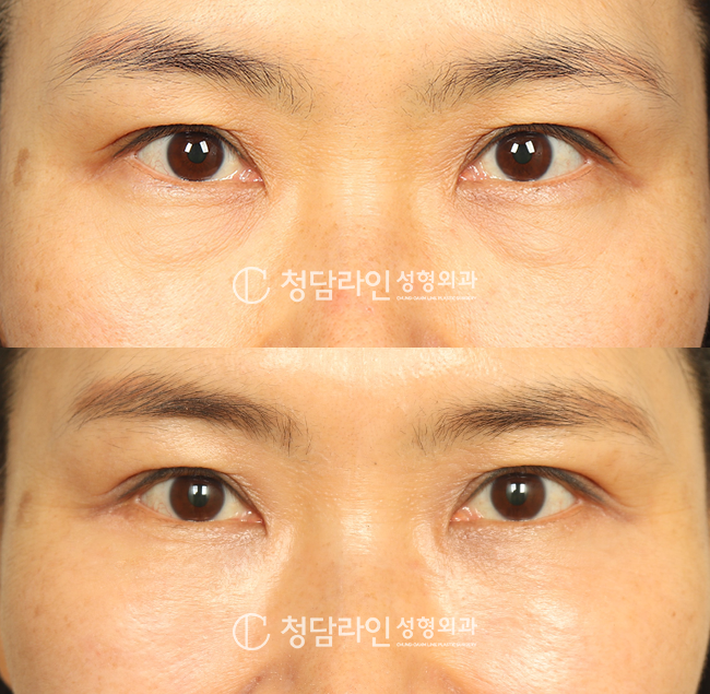Before Image