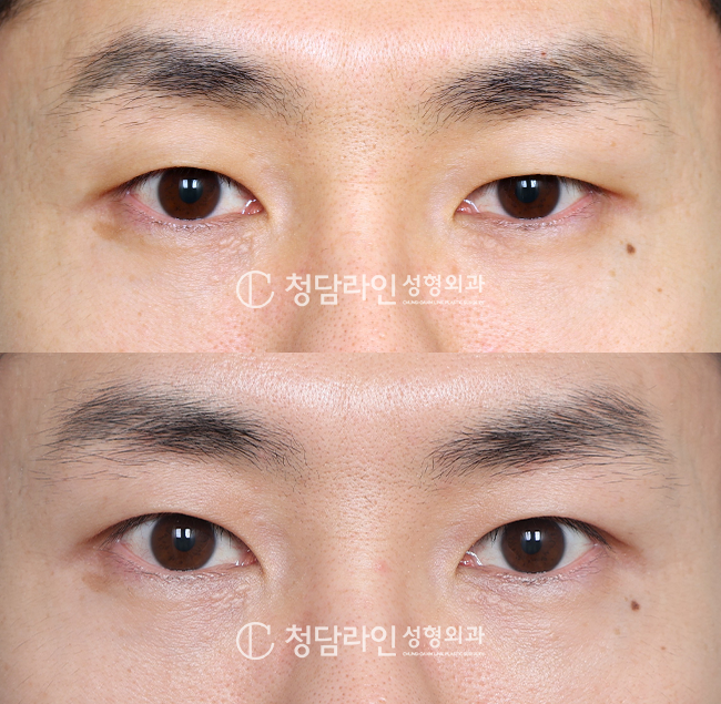 Before Image