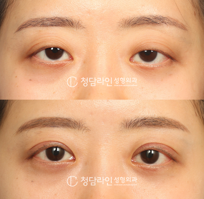 Before Image
