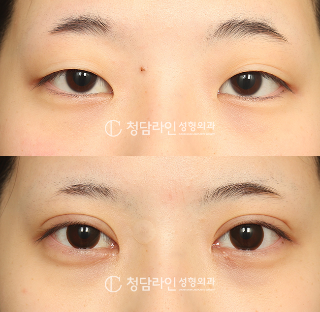 Before Image
