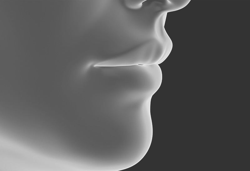 일반 인중 오목